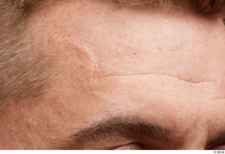 HD Face Skin Steve Q eyebrow face forehead hair scar…